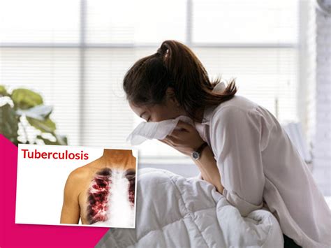 Ozone Therapy Can Ease Condition of TB Patients, Says Expert | OnlyMyHealth