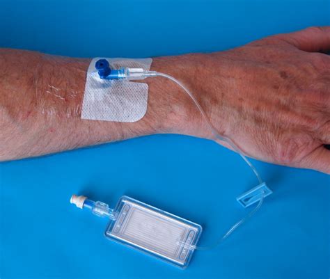 Intravenous (IV) antibiotics
