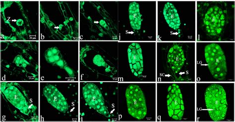 Ovule Development and in Planta Transformation of Paphiopedilum Maudiae ...