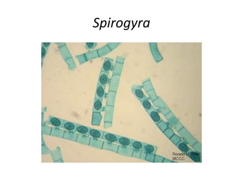 Image result for Echiler Classification System