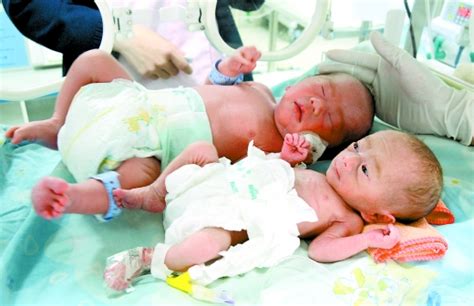 女子产下双胞胎：哥哥体重4斤 弟弟仅700克_社会新闻_温州网