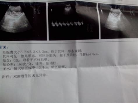 孕84天，妊娠囊6.7*5.2*3.3cm,是圆形还是长型的？ - 百度宝宝知道
