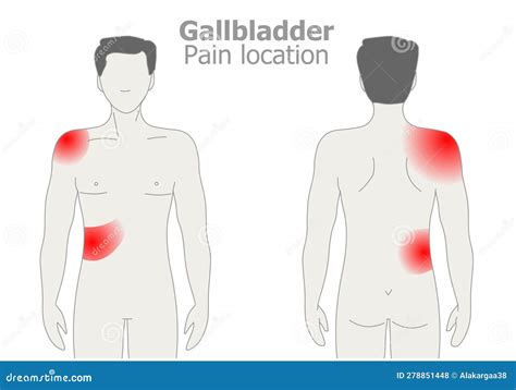 Gallbladder Pain Location Diagram Bile Duct Diseases Harvard Health