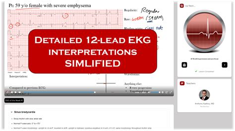 Image result for Basic EKG Training