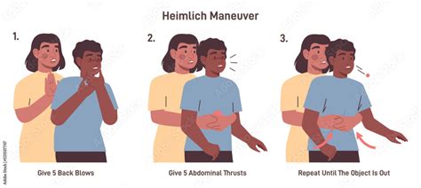 Choking first aid for adult. Heimlich maneuver procedure to remove ...