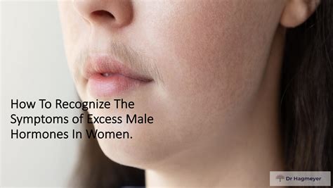 How To Recognize The Symptoms of Excess Male Hormones In Women. | Dr. Hagmeyer