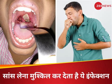 symptoms of Diphtheria infection caused 5 deaths in odisha prevention ...