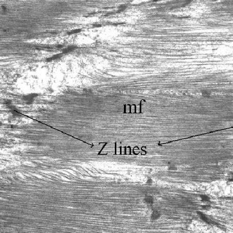 Image result for Muscle Fiber Z-Line