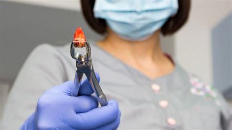 Extracting Abscessed Tooth 的图像结果