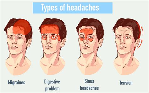 Sinus Headache Without Congestion