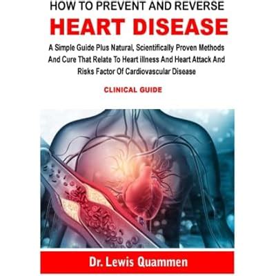 Buy HOW TO PREVENT AND REVERSE HEART DISEASE: A Simple Guide Plus ...