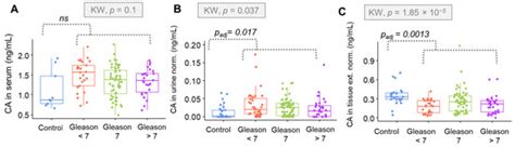 Citric Acid as a Potential Prostate Cancer Biomarker Determined in ...