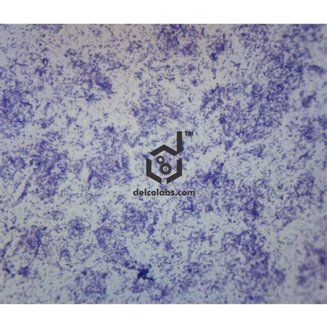 Biology – Prepared Microslides Delcolabs, India