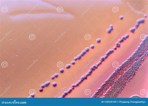 Colony Characteristics of Escherichia Coli E. Coli. Stock Image - Image of gram, evaluation ...