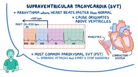 Psvt Heart Problem