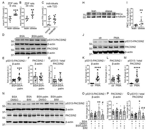 Phosphorylation of PACSIN2 at S313 Regulates Podocyte Architecture in ...