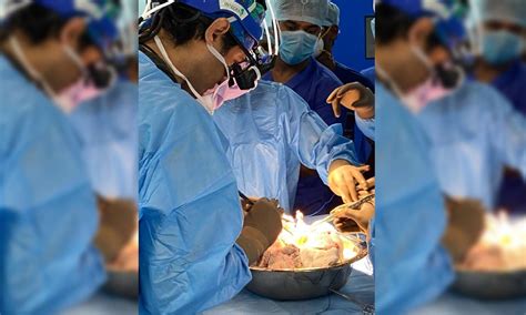 India's first breathing lung transplant surgery performed in Hyderabad