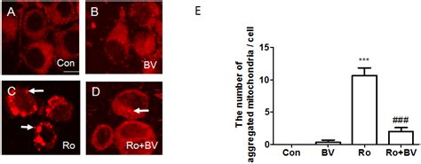 Bee Venom Protects against Rotenone-Induced Cell Death in NSC34 Motor ...