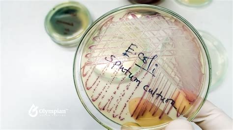 How Long Does E. Coli Live on Surfaces? - Olympian Water Testing, LLC