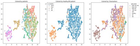 Diabetic Macular Edema Optical Coherence Tomography Biomarkers Detected ...
