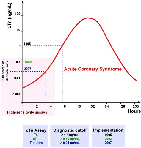 How to Interpret Elevated Cardiac Troponin Levels | Circulation