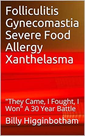 Folliculitis Gynecomastia Severe Food Allergy Xanthelasma: "They Came ...