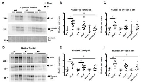 Sirtuin 7 Deficiency Reduces Inflammation and Tubular Damage Induced by ...