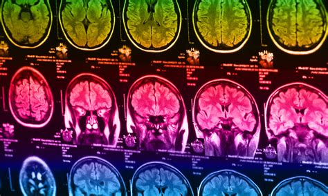 Image result for Brain Decimation