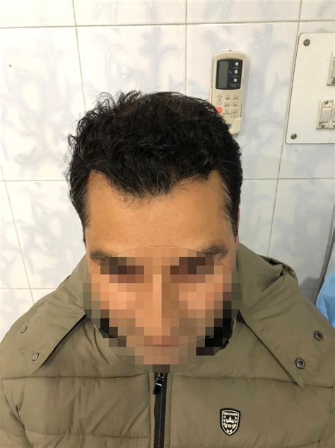 Home - Dr Ummer Yaseen's Skin, Laser And Hair Transplant Center