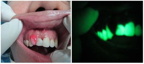 Healthcare Professional in the Loop (HPIL): Classification of Standard ...