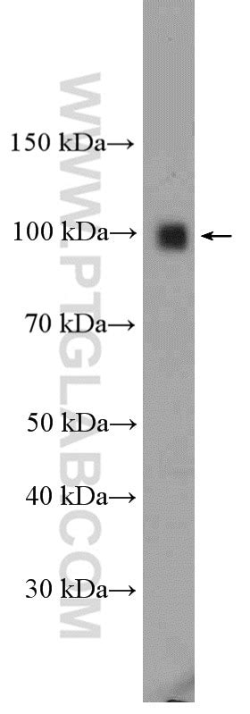 TLR4 antibody (19811-1-AP) | Proteintech