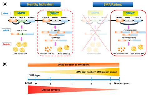 Spinal muscular atrophy (SMA) | Encyclopedia MDPI