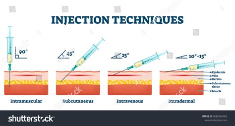 Image result for SubQ Injection Technique
