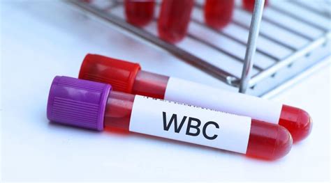 Image result for WBC Count Microscope