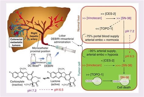 Toward a Better Understanding of The Mechanism Of Action for Intra-Arterial Delivery of ...
