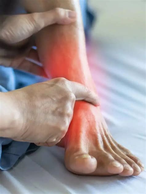 Hyperuricemia என்றால் என்ன? இதன் அறிகுறிகள் என்ன?| TamilSamayam