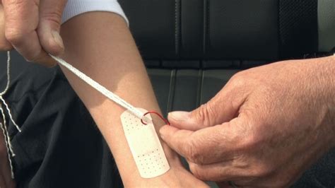 Image result for String Pull Method Fish Hook Removal