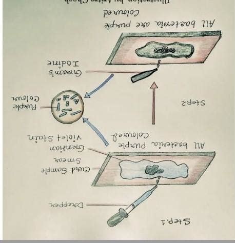 preparation of curd to find lactobacillus bacteria with the help of AIM ...
