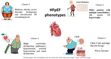 Heart Failure with Preserved Ejection Fraction | Encyclopedia MDPI