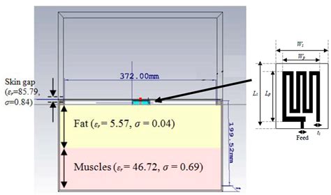 A Comprehensive Review of In-Body Biomedical Antennas: Design ...