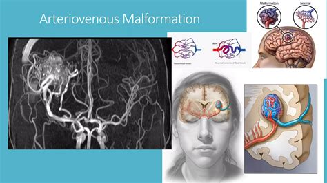 Magnetic Resonance Angiography and Venography | PPTX
