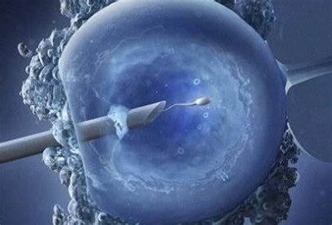 Image result for Vitro Fertilization IVF Process