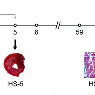 Image result for HS205 Worked Example