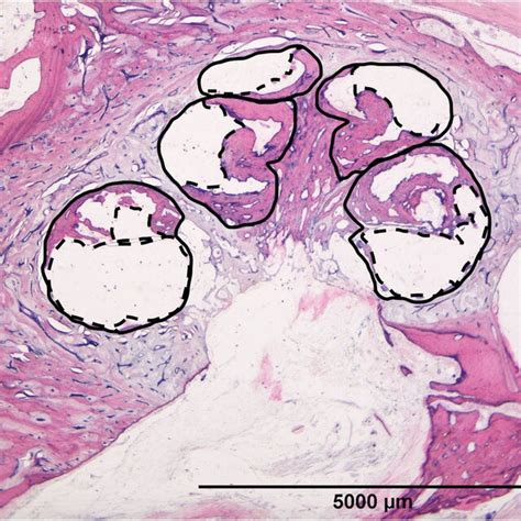 Image result for Modiolus Cochlea