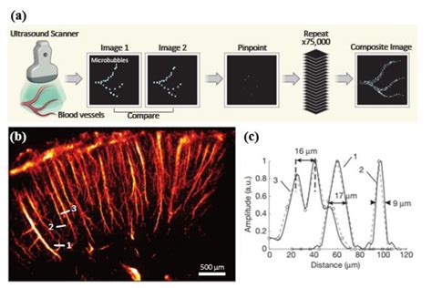 Current Development and Applications of Super-Resolution Ultrasound Imaging