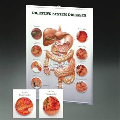 Buy Digestive System Diseases Book Online at Low Prices in India ...