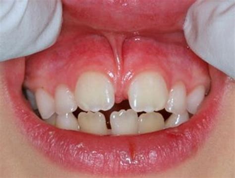 Surgical treatments | Blanc Dentistry