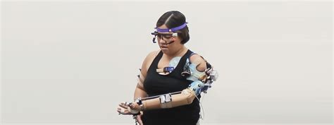 Image result for Bionic Arm Prosthetics