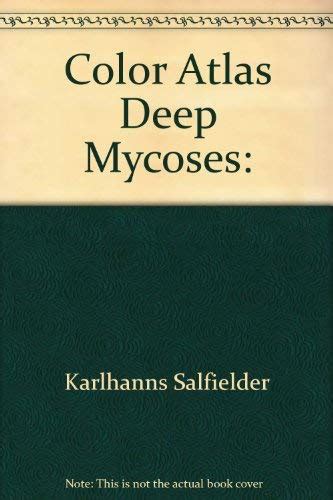 Atlas of Deep Mycoses : Amazon.in: Books
