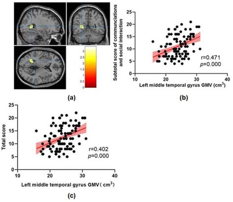 Abnormal Brain Structure Is Associated with Social and Communication ...